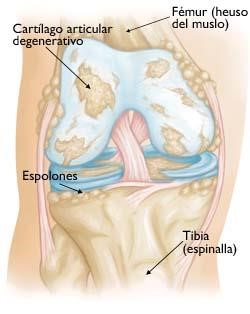 rodilla2 bicos